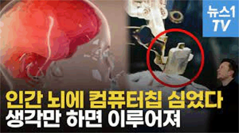 일론 머스크 “인간 뇌에 처음으로 인공칩 이식”