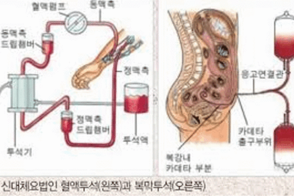 신장 질환