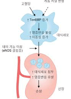 치료제도 없는 ‘당뇨성 신장병’ 원인 찾았다!