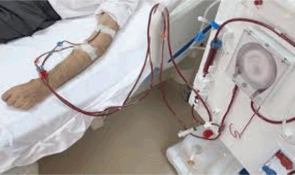 투석 Dialysis