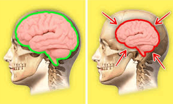 충분한 수면을 취하지 못하시나요? 신체와 뇌에 일어나는 일