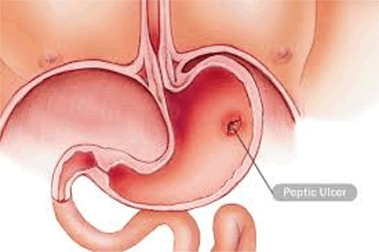 배가 아픈 이유